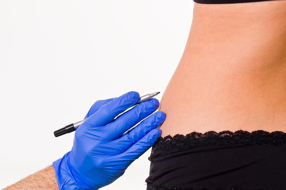 Business Plastische Chirurgie_168 Dr. Giovanni Bartellas – Plastische Chirurgie